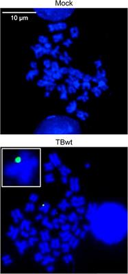 Evidence for Tethering of Human Cytomegalovirus Genomes to Host Chromosomes